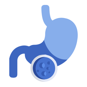 oncólogo, doctor, cáncer, estómago